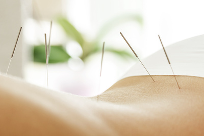 Link to: https://healthqiacu.com/pages/acupuncture-first-initial-follow-up-appointments